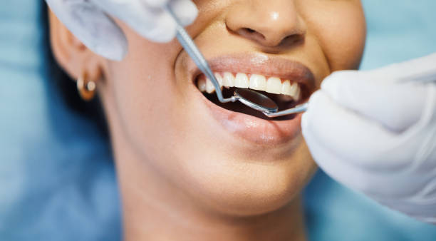 Best Emergency Dentist for Knocked-Out Tooth in Bradley Beach, NJ